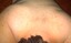 HNT - Back